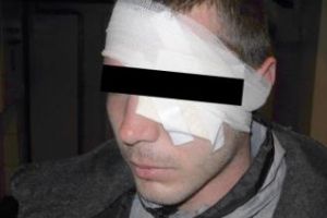 Clujean UMILIT şi bătut de doi gealaţi de faţă cu fosta iubită, care se amuza copios