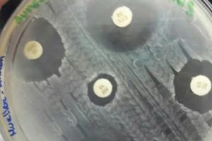 Raportarea infecţiilor de spital în judeţul Suceava rămâne sub 5%, în timp ce în restul ...