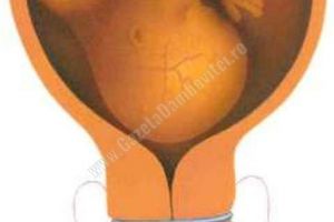 O GRAVIDĂ INFORMATĂ: Cerclajul