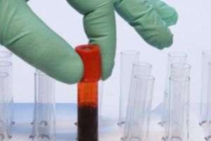 ALERTĂ - Măsuri în scandalul imunoglobulinelor: Va fi implementat un nou sistem / VIDEO