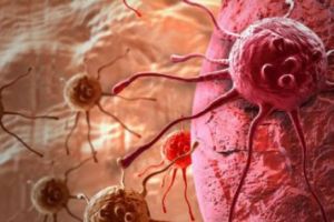 Un MEDIC neurolog celebru AVERTIZEAZĂ! Aşa APARE CANCERUL. Care sunt gândurile care ne ÎMBOLNĂVESC 