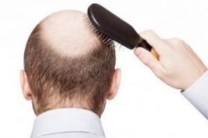 John Thomas – Ghidul tinereţii fără bătrâneţe (XLVIII): Chelia şi uleiurile alimentare