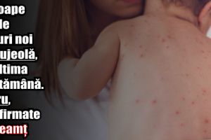 Aproape 90 de cazuri noi de rujeolă, în ultima săptămână. Patru, confirmate în Neamţ