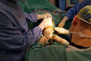 O nouă premieră medicală în Bistriţa-Năsăud (FOTO)