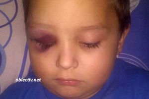 Ialomiţa: Educatoare acuzată de neglijenţă, după ce un copil s-a accidentat la grădiniţă