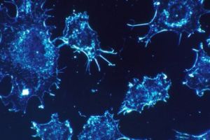 METODĂ REVOLUȚIONARĂ de TRATARE a CANCERULUI. SECRETUL , ascuns în MODIFICAREA celulelor T 