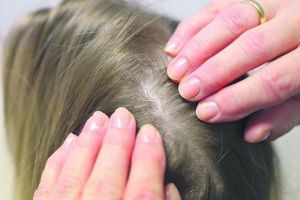 Ce s-a descoperit în urma triajului epidemiologic în şcoli: păduchi, varicelă, rujeolă