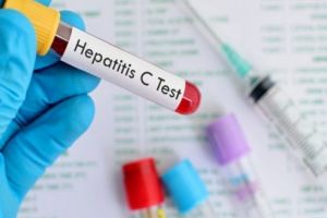 Acces mai bun la tratamentul fără interferon pentru bolnavii cu Hepatita C