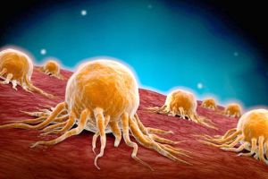 John Thomas – Ghidul tinereţii fără bătrâneţe (LVII): Masele canceroase