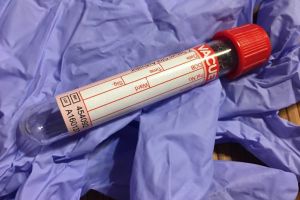 Tu ştii cum poţi preveni apariţia hepatitei B?