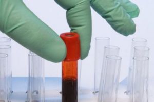 Alertă Europeană pentru imunoglobulină. Ministerul Sănătăţii e în război cu producătorii