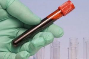 Ministrul Sanatatii: SUA au transmis ca au o solutie privind imunoglobulina