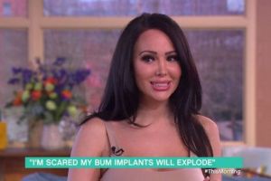 Şi-a pus atât de mult silicon, încât nu mai poate sta pe fund! 