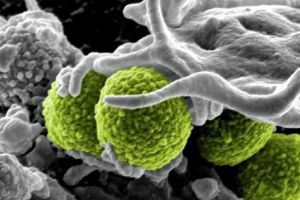 Întâlnire de URGENȚĂ la Geneva. LUMEA este în PERICOL! Boala X, CATASTROFA care poate UCIDE MILIOANE de oameni INSTANT. NU are LEAC!