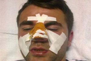  Premiera in istoria recenta a sportului constantean: Arbitrul Marian Carson, batut la meciul CSO Ovidiu - CS Eforie. Iata condamnarile!