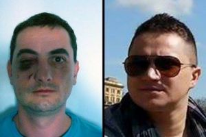 Golanul care a desfigurat  un medic in Copou, la un pas sa scape basma curata. Politia si parchetul au dormit 3 ani