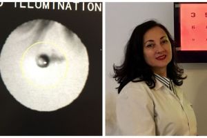 Cabinet oftalmologic din Alba Iulia, dotat cu aparatură de înaltă performanţă pentru afecţiunile de cataractă