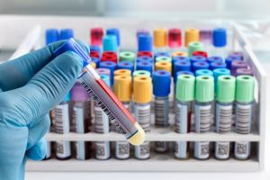 Tratamentul fără interferon pentru bolnavii cu hepatită C continuă