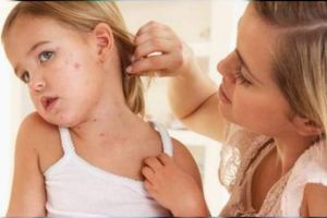 Copiii vulnerabili în faţa epidemiei de rujeolă. Doar 45% dintre ei sunt vaccinaţi, iar numărul deceselor creşte