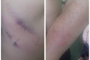 FOTO ȘTIREA TA: Tânăr din Ocna Mureş, în spital după ce ar fi fost bătut de un poliţist aflat în timpul liber, pe motiv că nu a vrut să se legitimeze