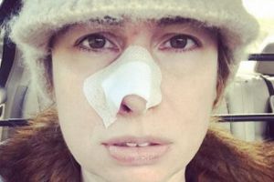 Căţeluşa  îi FIXA mereu NASUL cu privirea. Aşa a DECOPERIT stăpâna că avea o TUMOARE la NARĂ. Foto în articol