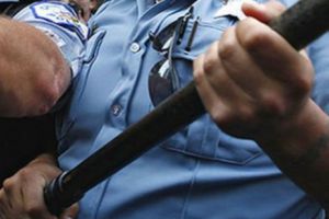 POliţişti acuzaţi că au bătut cu bestialitate un băiat de 16 ani. Copilul e internat în spital I FOTO - VIDEO