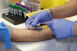 Pete albicioase în gura si leziuni dureroase care se înmulţesc. Cum se trateaza  	