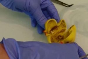 SUPERBACTERIA pentru care NU există TRATAMENT