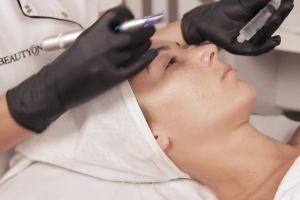 Încearcă tratamentele faciale cu micro-ace şi fiole BCN