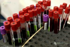 Persoanele de peste 60 de ani care slăbesc brusc ar trebui supuşi urgent unor teste pentru depistarea cancerului