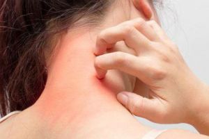 Cum scapi de bolile pielii cu tratamente naturale 