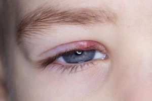 Amestecul de plante care vindeca urciorul 