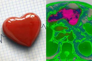 Anunţ important al medicilor: Alimentele sănătoase mâncate în exces pot dăuna grav sănătăţii