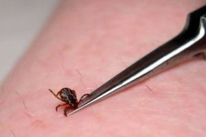 A început sezonul căpuşelor! Care sunt primele semne că ai fost muşcat şi soluţiile de urgenţă