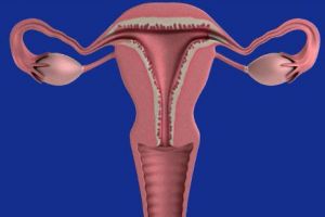 Două simptome care iti spun ca ai cancer ovarian. Nu le ignora! 