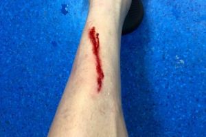 ​Se putea alege cu o accidentare grava!: Iata cum arata piciorul lui Ianis Hagi, dupa intrarea foarte dura a lui Madalin Mihaescu, de la Poli Iasi