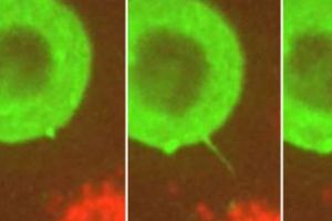 Transmiterea HIV. PREMIERĂ ŞTIINŢIFICĂ. Cercetătorii francezi au intrat în istorie. VIDEO. Breaking news