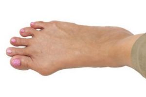 Remedii naturiste pentru monturi. Ce poti face ca sa scapi de problema care iti da batai de cap 