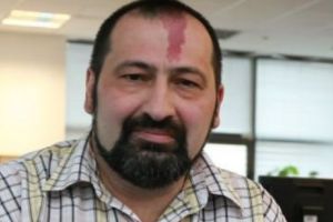 DOLIUL în ROMÂNIA! Hanibal Dumitraşcu, răpus de un accident vascular