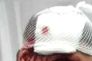 Se întâmplă la Botoşani! O femeie a fost arestată după ce şi-a bătut bărbatul şi l-a băgat în spital