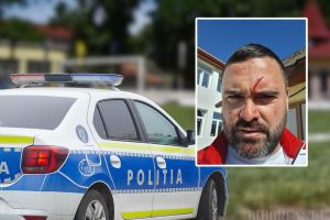 Scandal la un meci de copii U15 din Bihor: antrenorul echipei Crişul Aleşd, bătut după partidă, a rămas cu doi dinţi rupţi