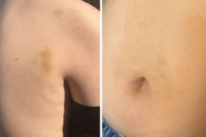 Cazul copilului bătut de tatăl unui coleg în parc la Sibiu: are fractură nazală, iar mama a cerut ordin de protecţie