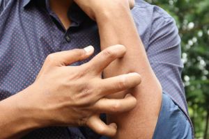 De ce poate apărea o senzaţie de mâncărime după ce muşcăm dintr-un măr. Ce spun specialiştii în alergii