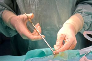 Intervenţie salvatoare pentru o tânără mamă. Medicii arădeni i-au extirpat o tumoră cerebrală agresivă de mari dimensiuni