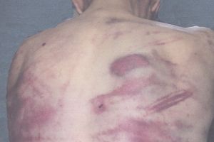 Caz tulburător într-o unitate medicală din Botoşani! Pacient bătut pentru că nu voia să doarmă