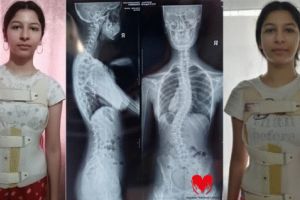 Erika, 15 ani: „Fiecare zi îmi curbează coloana tot mai mult… Operaţia este şansa mea”/ FOTO