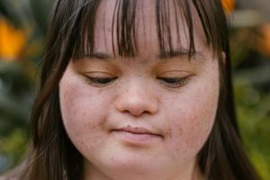 Singurătatea, „duşmanul invizibil”. Apel la solidaritate lansat la Timişoara de Ziua Mondială a Sindromului Down