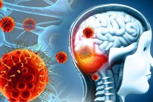 Alertă medicală! Focare de meningită şi în România