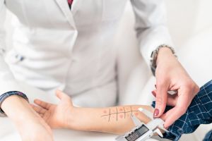 Mii de consultaţii pentru alergii, la Spitalul Judeţean