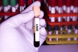 Rolul AMH în evaluarea rezervei ovariene